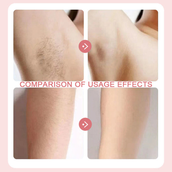 2-i-1 bikinidamebarbermaskine til kvinder, Silky Glide Pro hårfjerning til barbering af ben, arme, underarme og ansigt, blå