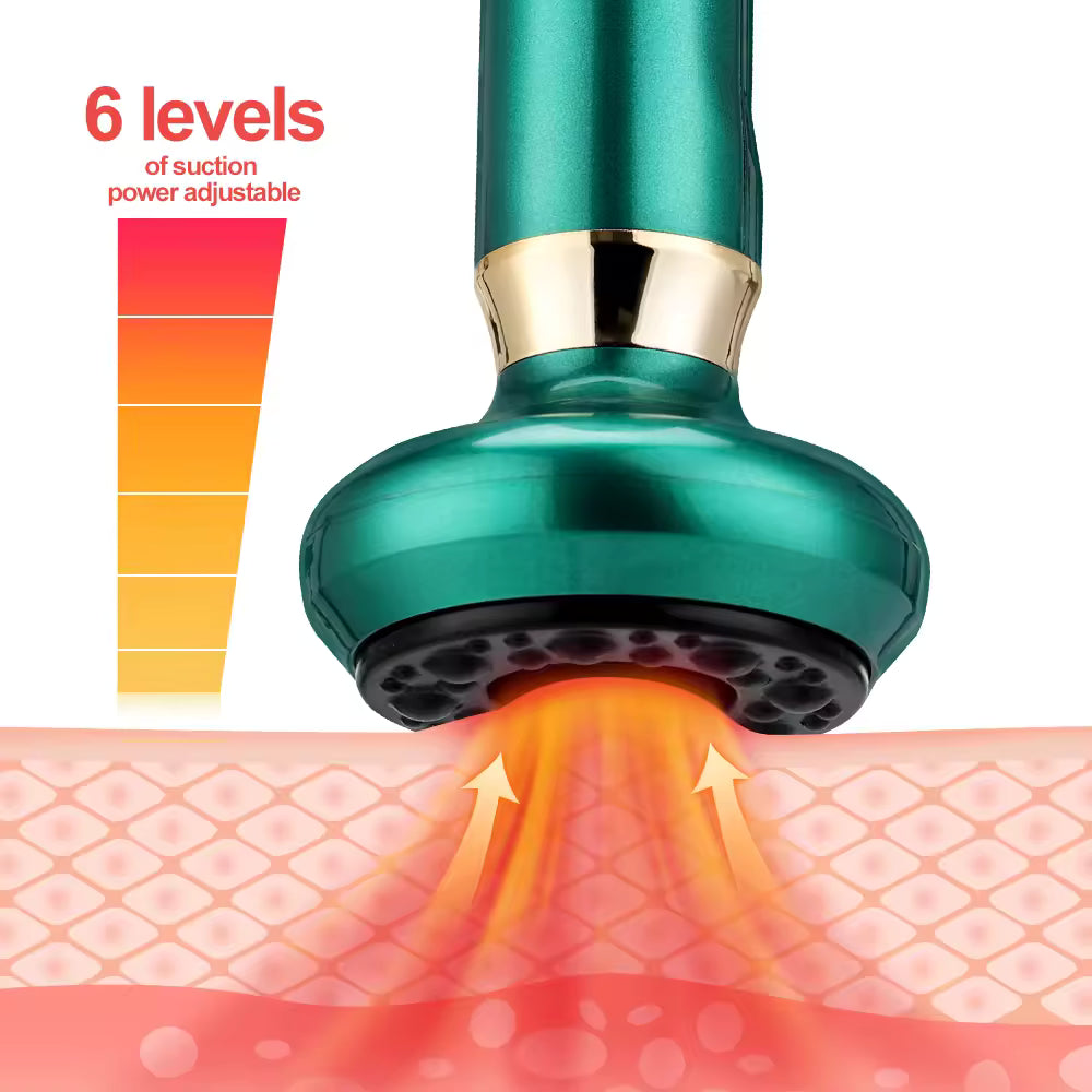 6-Level Electric Cupping Massager — Slimming Vacuum Cupping Device with Gua Sha, Anti-Cellulite, Beauty, Scraping, and Infrared Heating